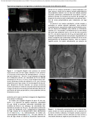 Qu Son Las Causas De Una Fuga Venosa En El Pene Fuga Venosa